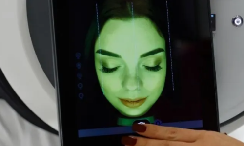 ANÁLISIS FACIAL Y CAPILAR